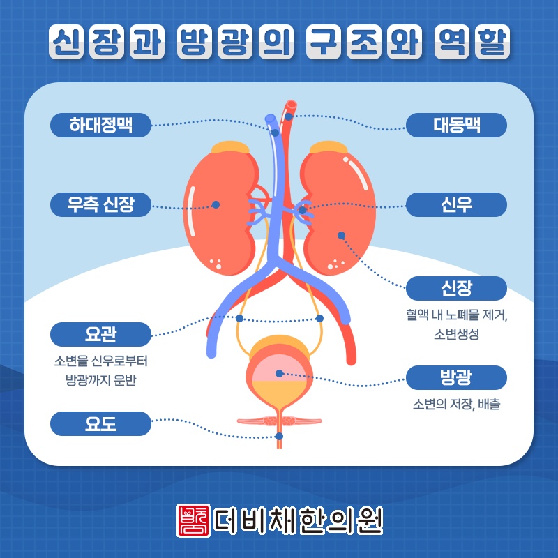 만성 방광염의 특성을 고려한 지속적인 관리 방법