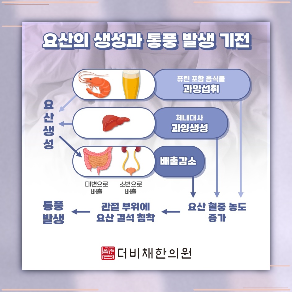가벼운 바람에도 통증이 느껴지는 통풍의 특징