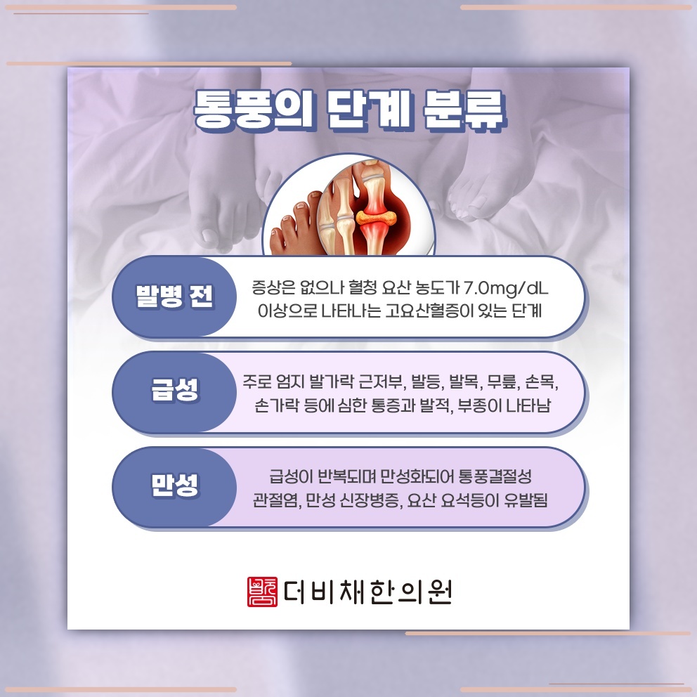 가벼운 바람에도 통증이 느껴지는 통풍의 특징