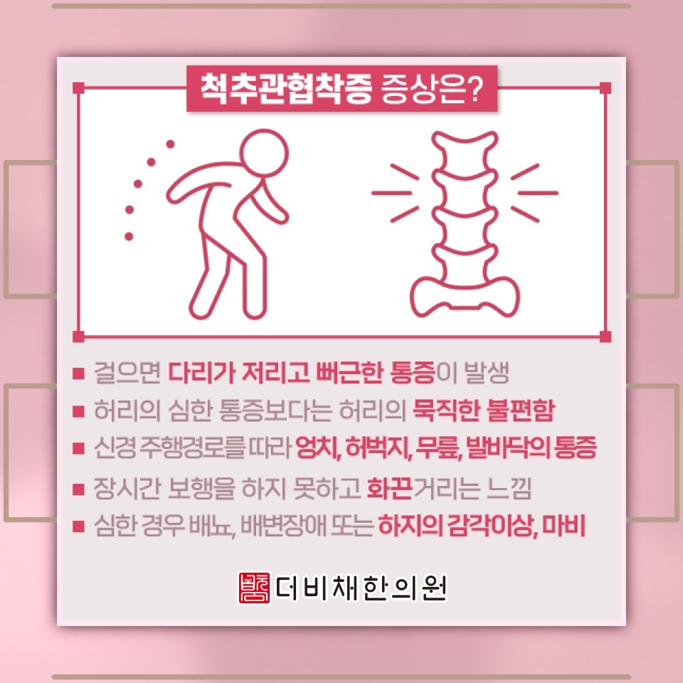 척추관협착증의 진행 과정과 알아두어야 할 주요 신호