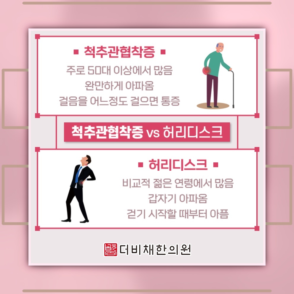 척추관협착증의 진행 과정과 알아두어야 할 주요 신호