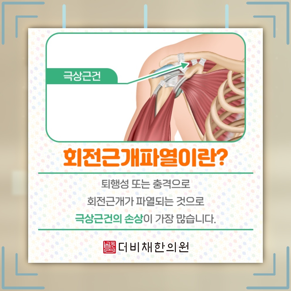 회전근개파열의 수술 여부를 판단하는 주요 기준