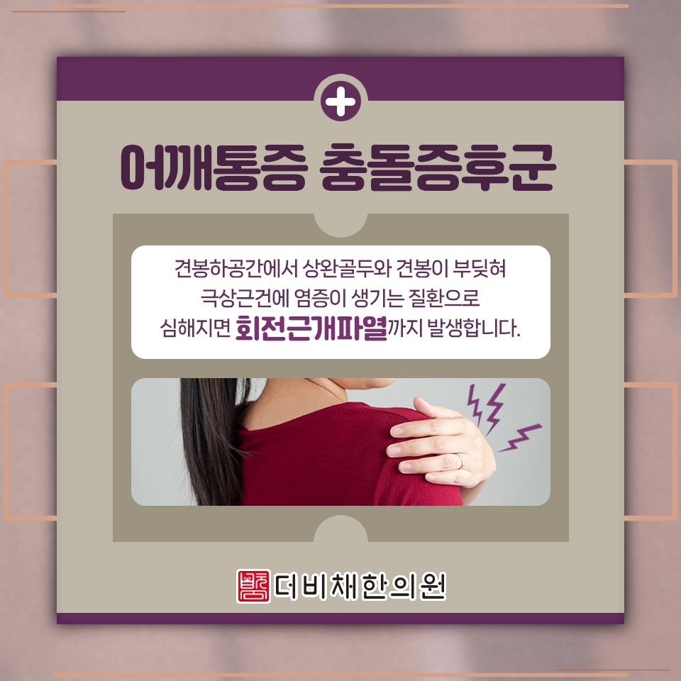 충돌증후군 통증 완화를 돕는 비수술적 관리 방법
