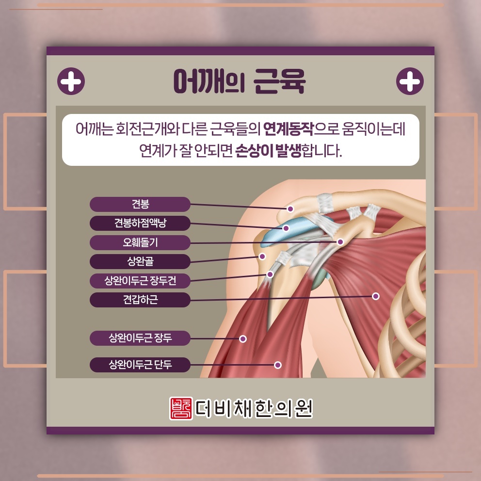 충돌증후군 통증 완화를 돕는 비수술적 관리 방법