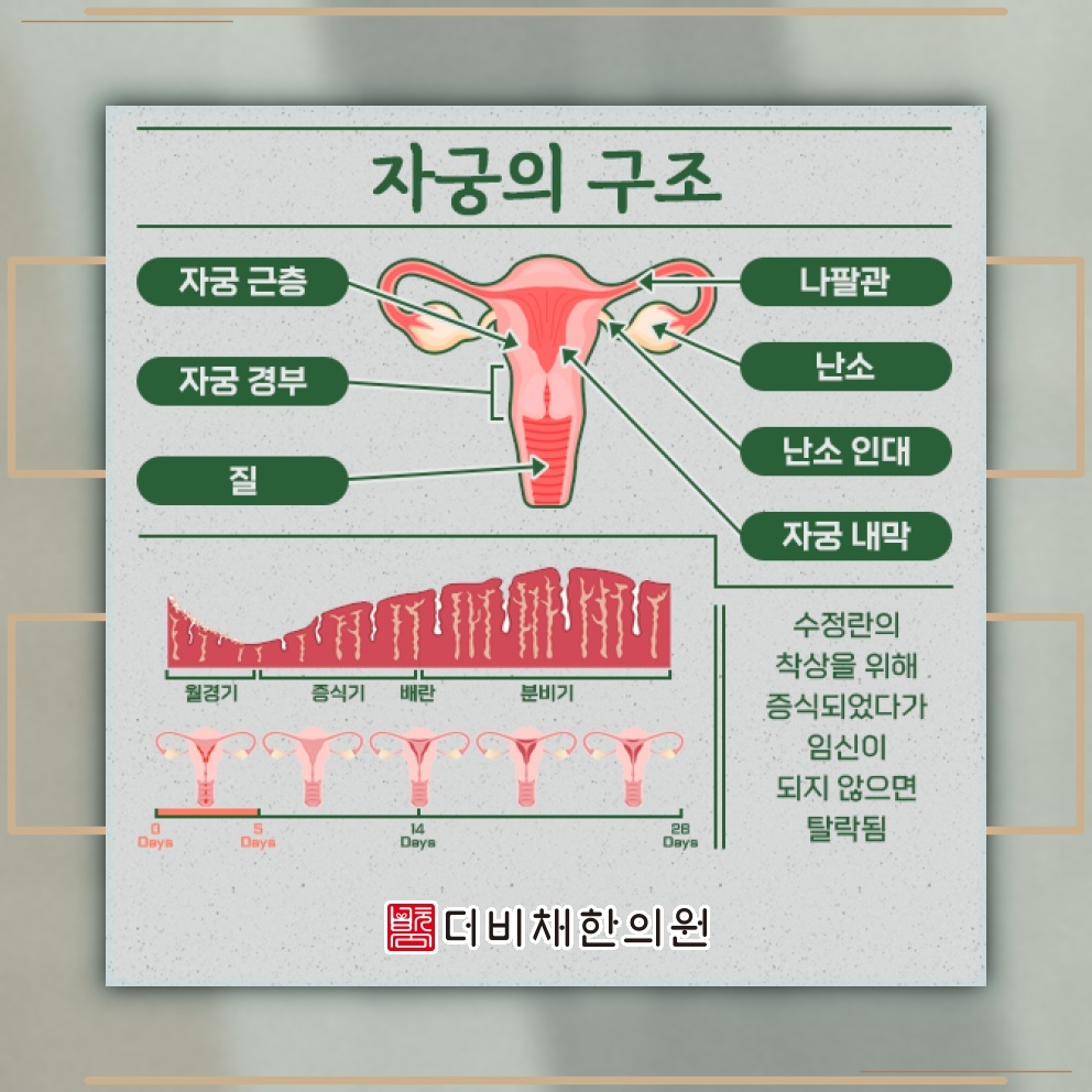 반복되는 생리통, 익숙함보다 원인 확인이 먼저