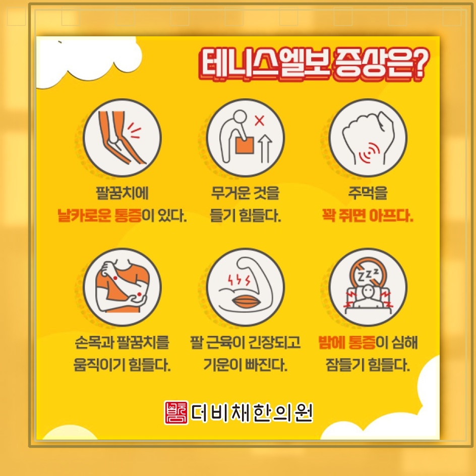 팔꿈치 바깥쪽이 시큰할 때 알아보는 테니스엘보