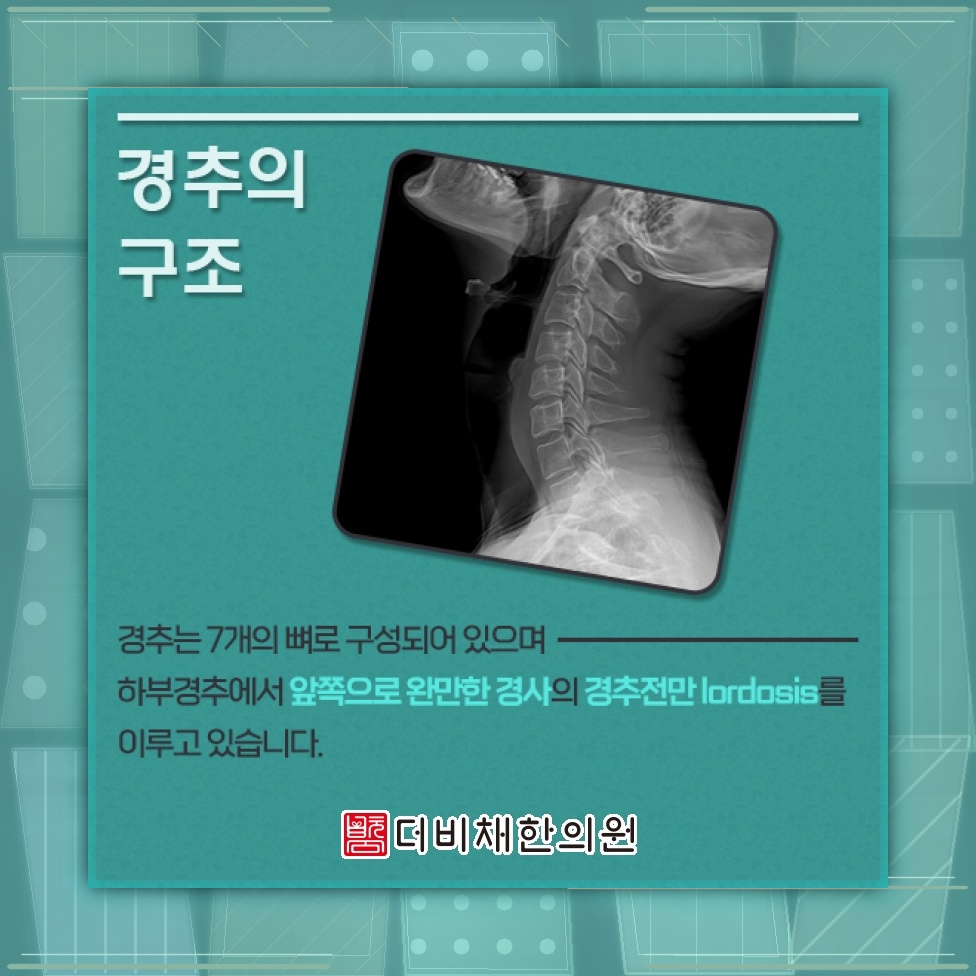 장시간 컴퓨터 작업이 부르는 거북목증후군 살펴보기