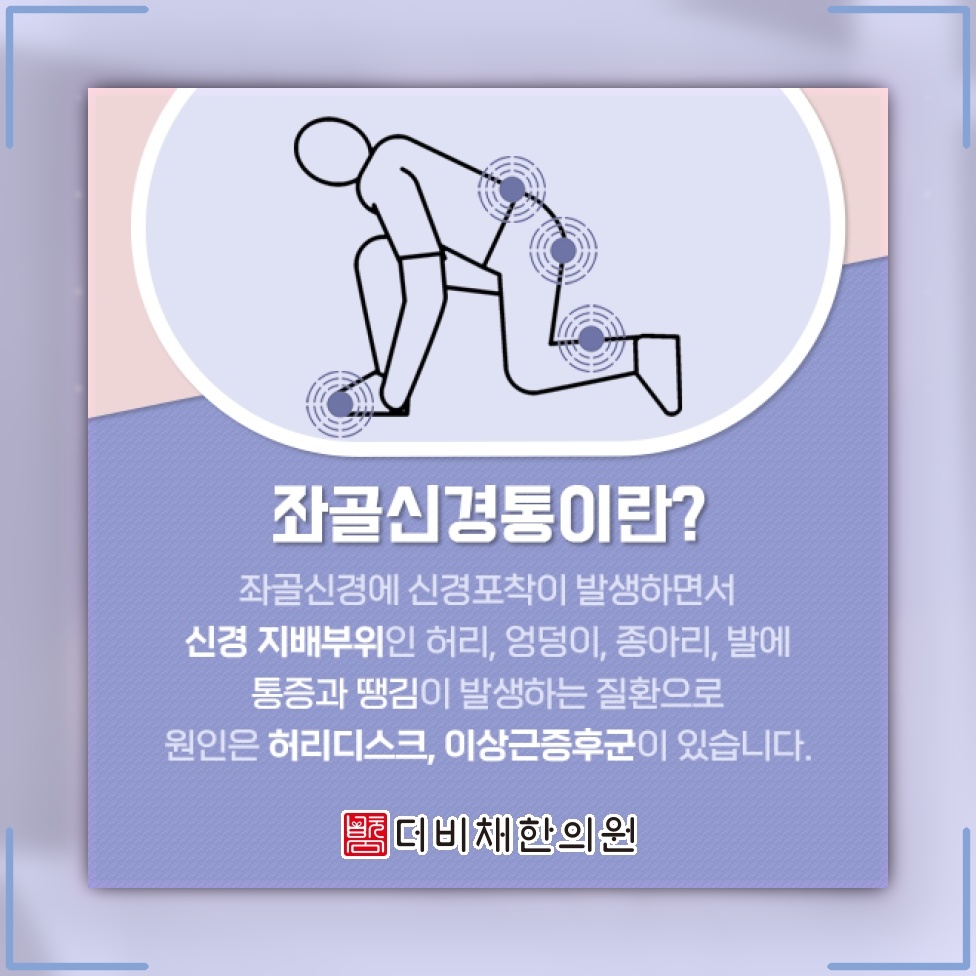 좌골신경통이 나타날 때 통증 양상과 일상 관리법