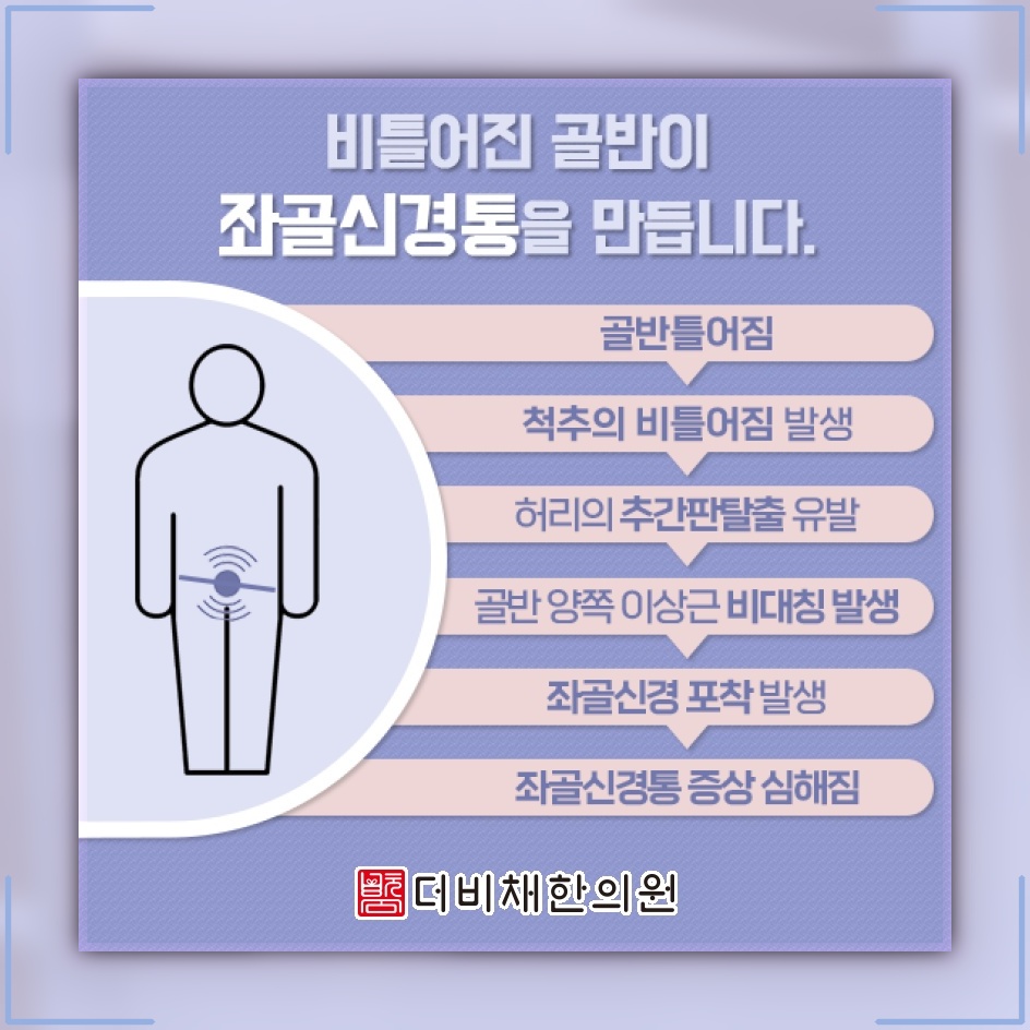 좌골신경통이 나타날 때 통증 양상과 일상 관리법