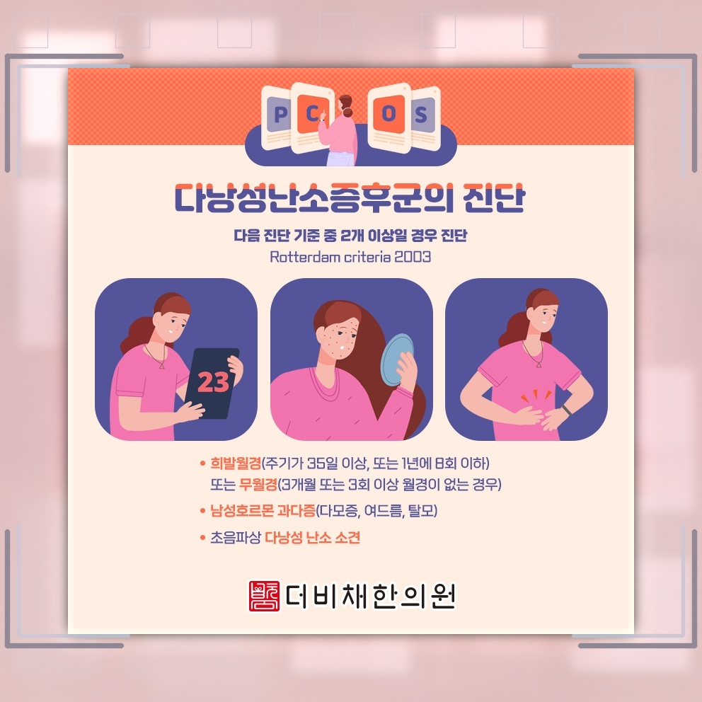 가임기 여성의 배란 이상과 관련된 다낭성난소증후군