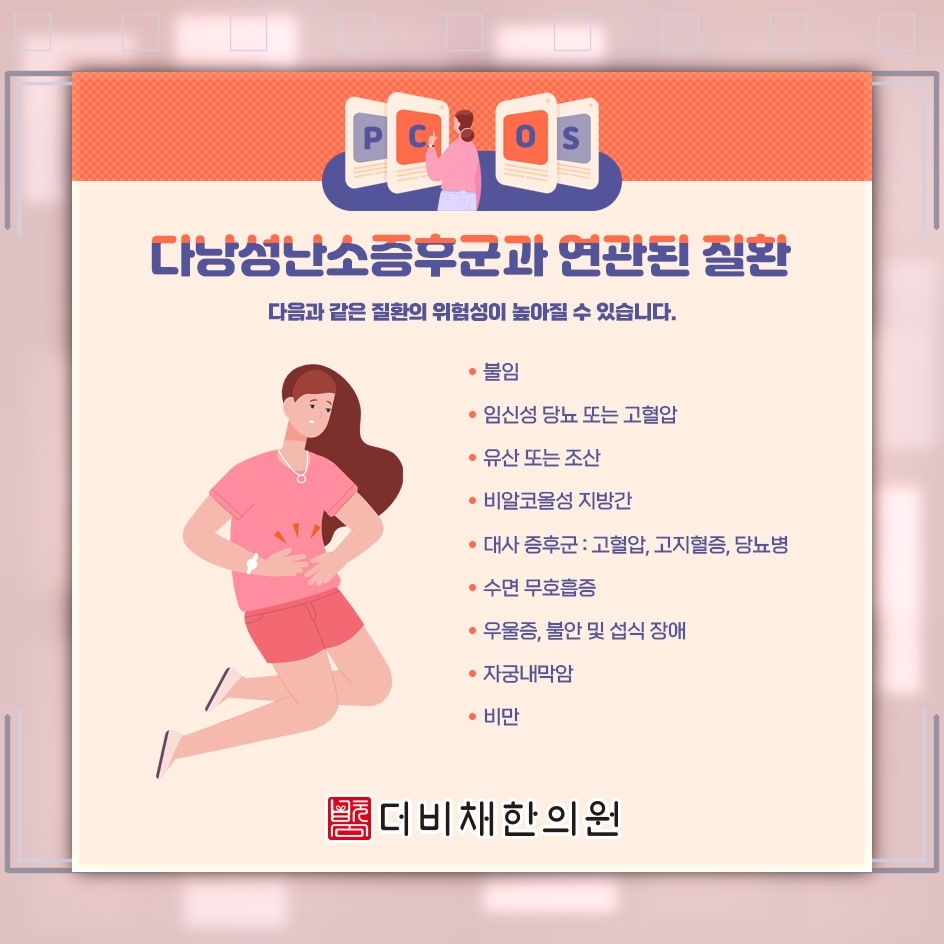 가임기 여성의 배란 이상과 관련된 다낭성난소증후군