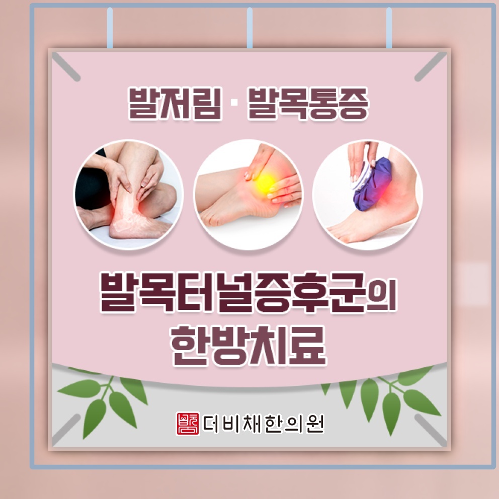 발목터널증후군에서 나타나는 발목 저림과 보행 불편.tensor