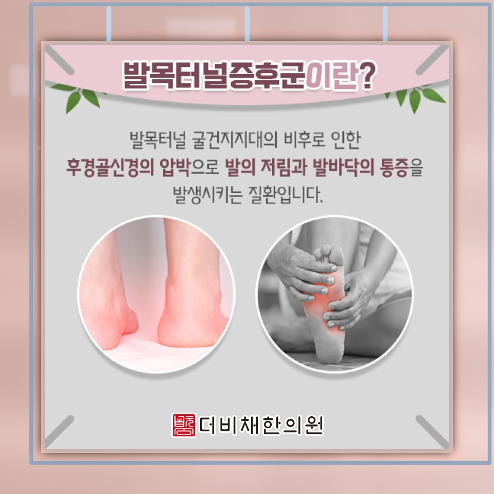 발목터널증후군에서 나타나는 발목 저림과 보행 불편.tensor