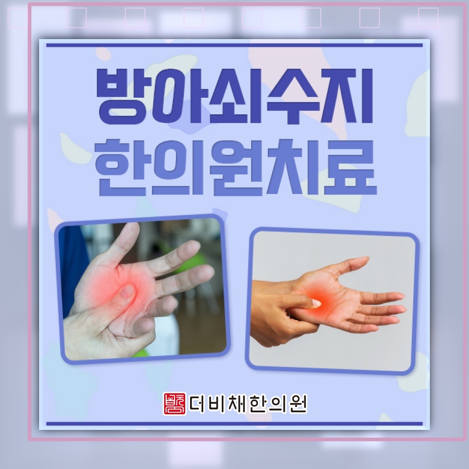 방아쇠수지로 손가락을 구부릴 때 느껴지는 걸림